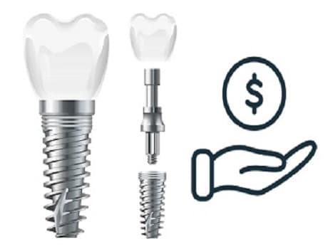 İmplant Fiyatları